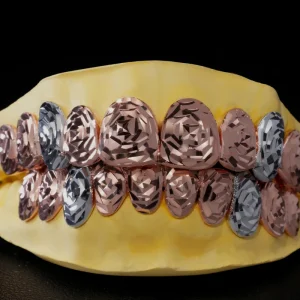 Hip Hop Rose Gold-Plated Solid 925 Sterling Silver Teeth Grillz Custom 10-on-10 Deep-Cut Fit
