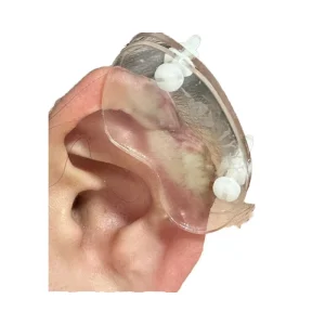 The Ear Press’s Quality and Effectiveness for Keloid Recovery Keloid Pressure Earrings Clip On Compression Earring for Swelling